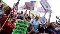 Günün fotosu: ABŞ-da abort hüququ qadağan edildi