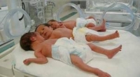 Azərbaycan əhalisinin sayı 10 milyon 157 min 406 nəfərdir